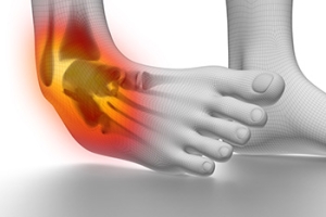 Surgical Interventions for Severe Ankle Sprains