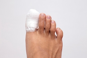Toe Fractures and the Different Ways They Happen