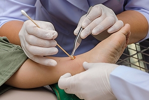 Diabetes and Foot Ulcers