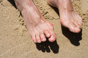 Shoes and Hammertoe