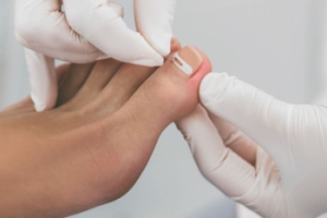 Recognizing Infection After Toenail Removal Surgery