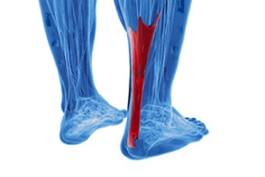 Causes of an Achilles Tendon Injury