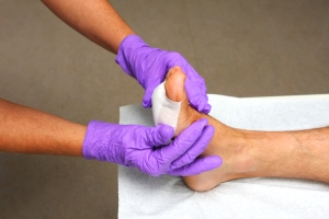 Keeping Pressure Off Foot Wounds