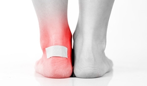To Pop or Not to Pop (Your Blister)